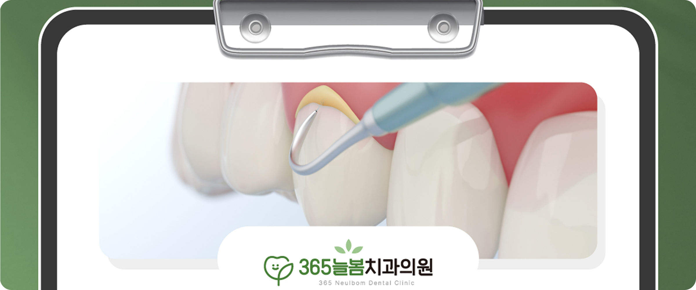 서동미로시장치과, 스케일링 왜 주기적으로 받아야할까?